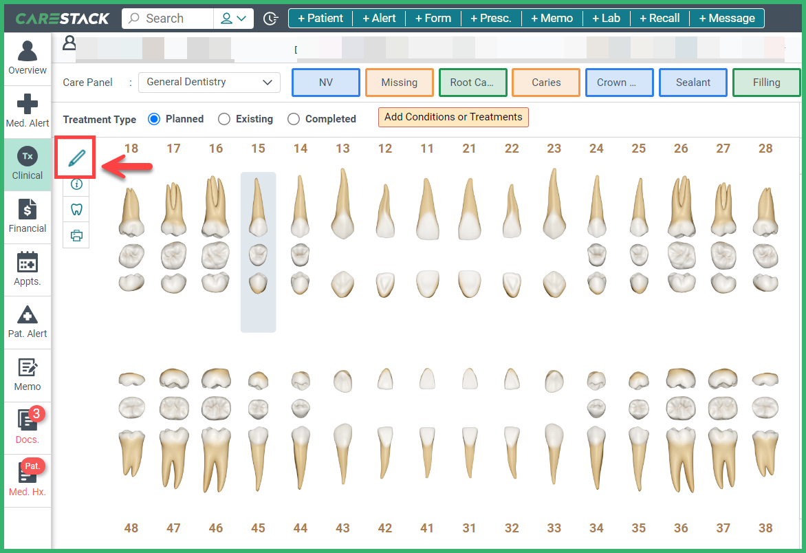 Draw on the Tooth Chart – CareStack